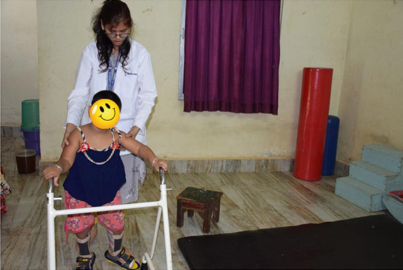 cerebral palsy treatment